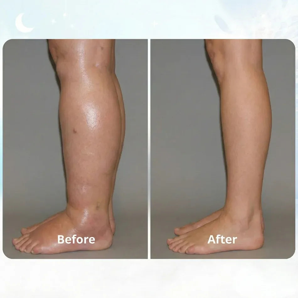 RESTIVA™ - EMS FIX SWOLLEN LEGS FROM HOME