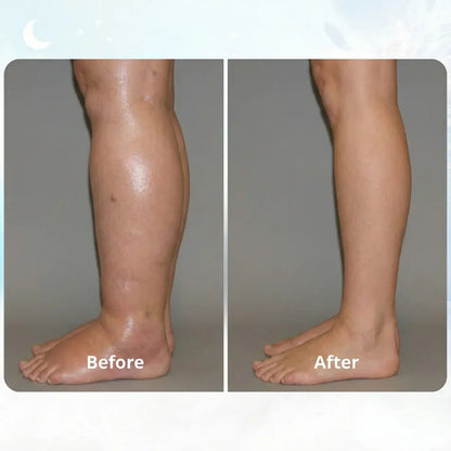 RESTIVA™ - EMS FIX SWOLLEN LEGS FROM HOME